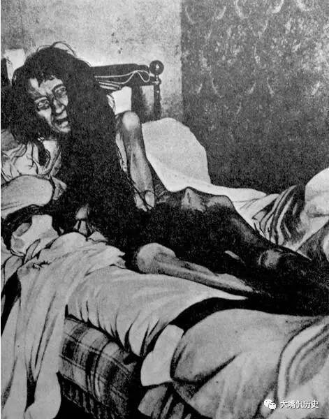 这位是布兰琪，她的故事与其说可怕不如说可怜。布兰琪爱上了一名男子，便告诉妈妈要嫁给他，但妈妈却不同意 。许多人都以为布兰琪最后跟男子私奔了，但过了25年，警方才发现布兰琪其实一直都被母亲锁在家里，就是为了避免布兰琪跑出去找她心爱的男人。当布兰琪被发现时体重仅剩24公斤，最后布兰琪的妈妈死在牢里，布兰琪则是多年后死在疗养院里。这个妈妈有多变态啊！！