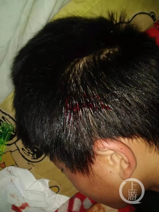 孩子头部伤势严重,有大片渗血./受访者供图