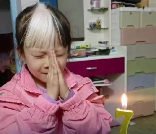 7岁女孩患罕见斑驳病