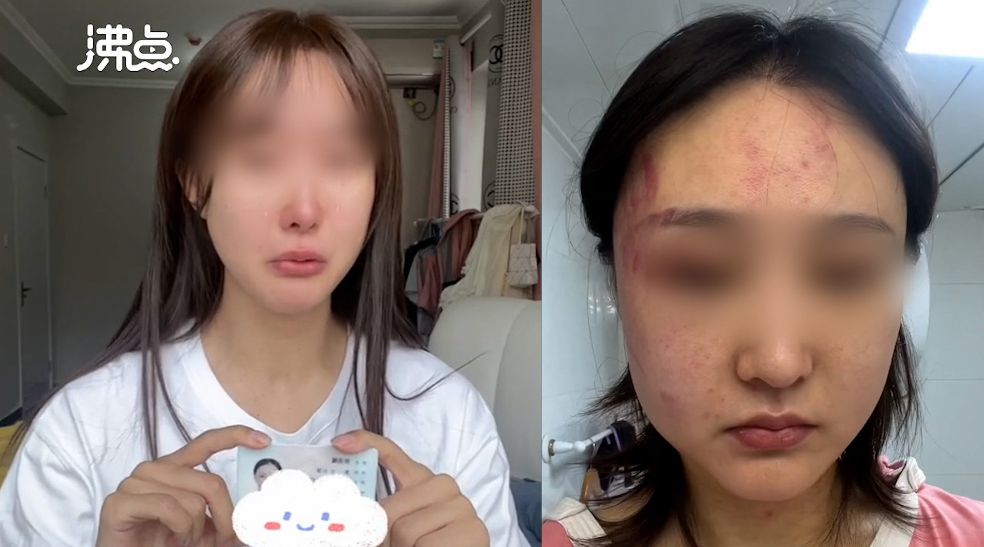 女网红实名举报遭丈夫多次家暴脸部多处伤痕警方已出具家庭暴力告诫书