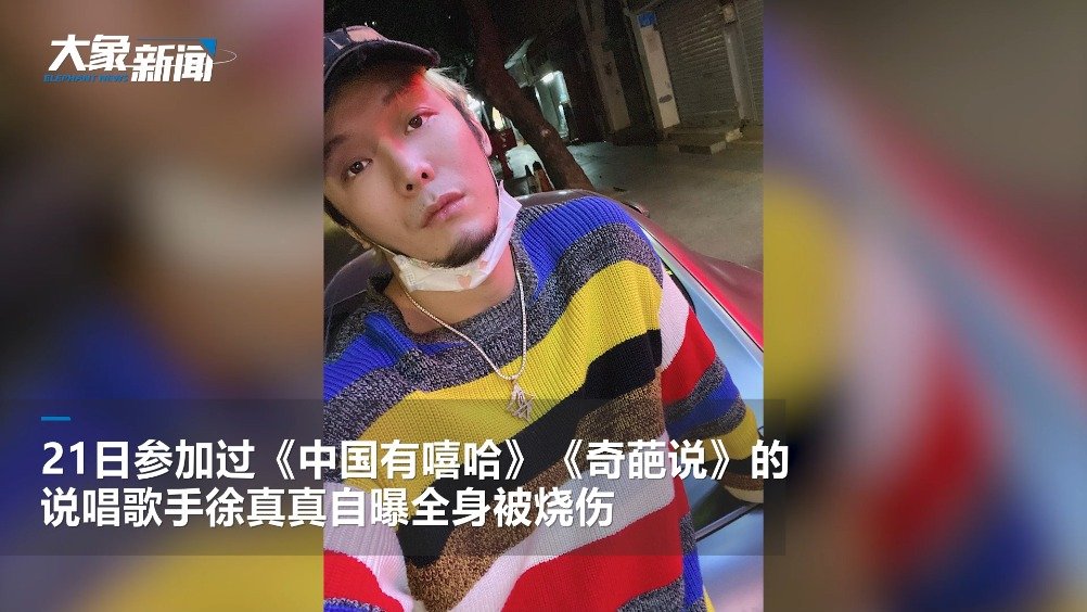 说唱歌手徐真真二级深度烧伤因睡前未熄灭香薰蜡烛引发火灾