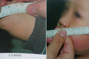 吉林红黄蓝幼儿园虐童案 四名教师被判刑