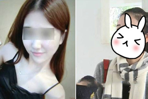 19岁女孩整容当网红 术后竟从鼻子掉出异物…