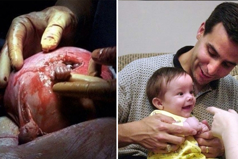 所有人都放弃时 他从子宫内伸出手抓住医生