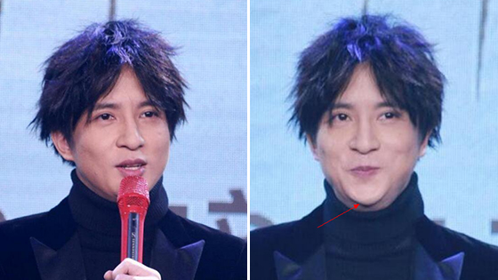 薛之谦发布会笑太开心 意外暴露下巴假体？