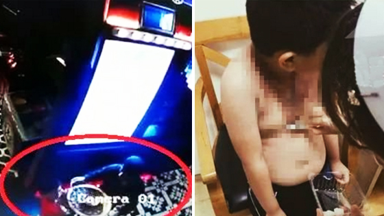 火锅汤底泼男童一身 只因男孩的这个动作