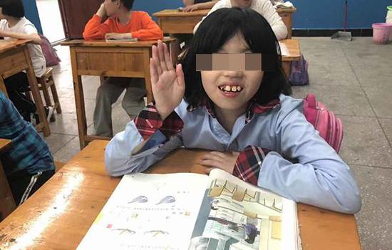 重庆智障女孩一家贫困出了名