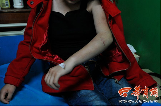 14岁女孩宿舍被同学围殴称因用手指了一名同学