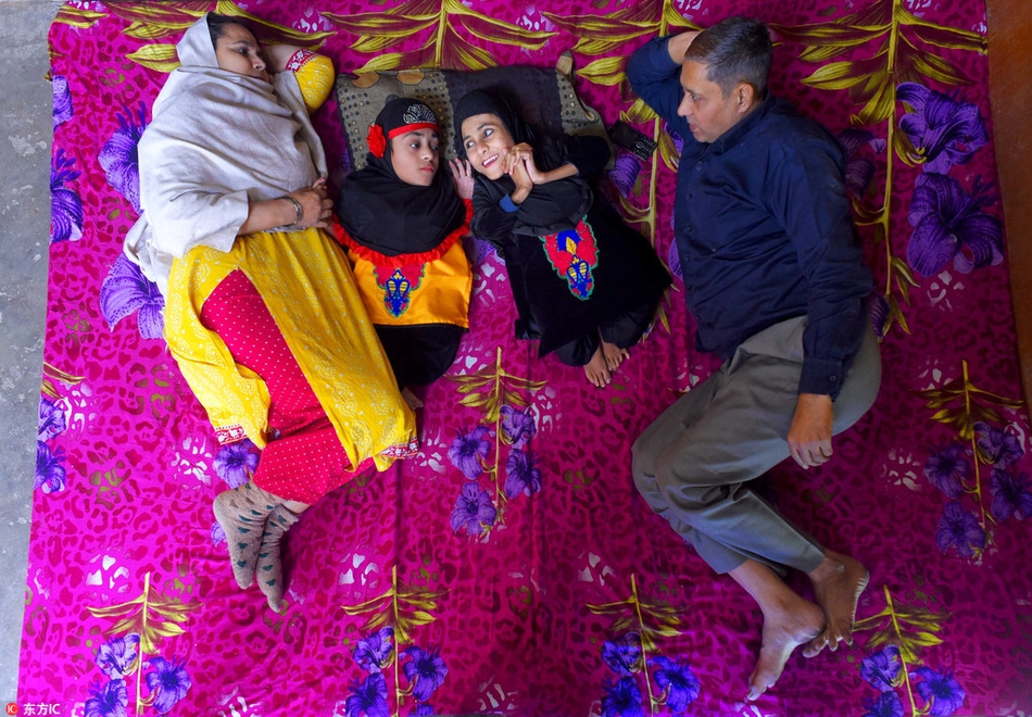 姐妹花患成骨不全症正能量满满