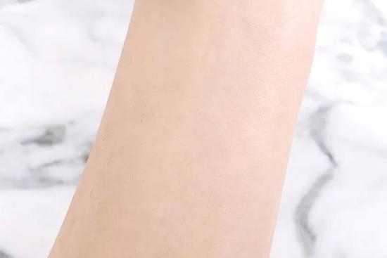 美美们长痘老不好 多半是没救了?