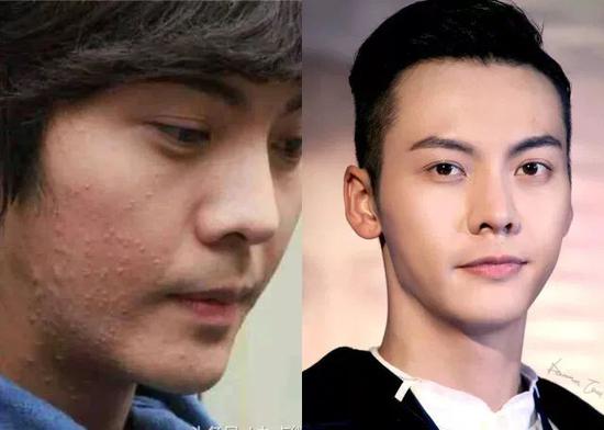 王俊凯|洗面奶|长痘_新浪时尚_新浪网