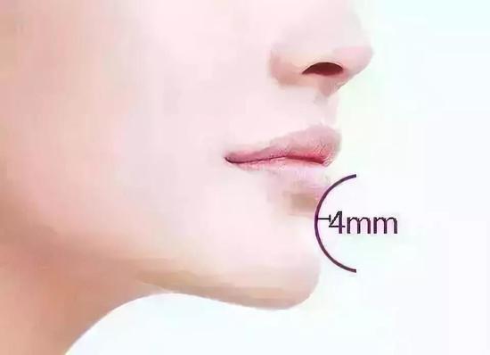 唇与下巴之间(即颏唇沟)有较明显的美学凹陷,标准颏唇沟深约4mm.