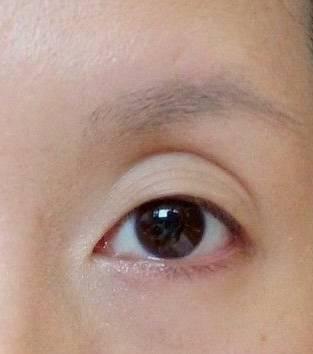 醒醒吧这样的眼窝不是欧化是老化