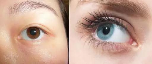东西方人的眼部差异在于虹膜的颜色,有无内眦赘皮,当然还有眼窝的深浅