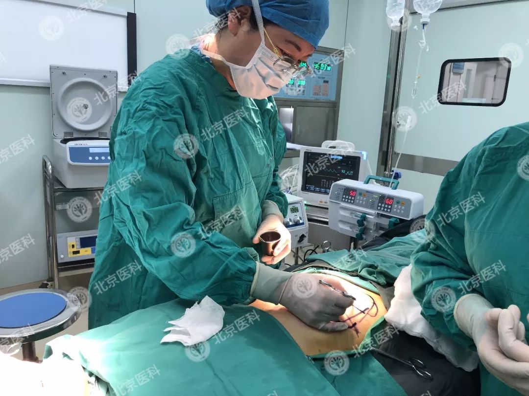 关于吸脂你需要知道这些