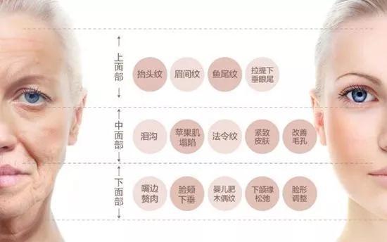 线雕提升你想知道的15大问题都在这里了