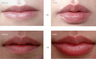 性感or清纯,她们收获爱情靠的是