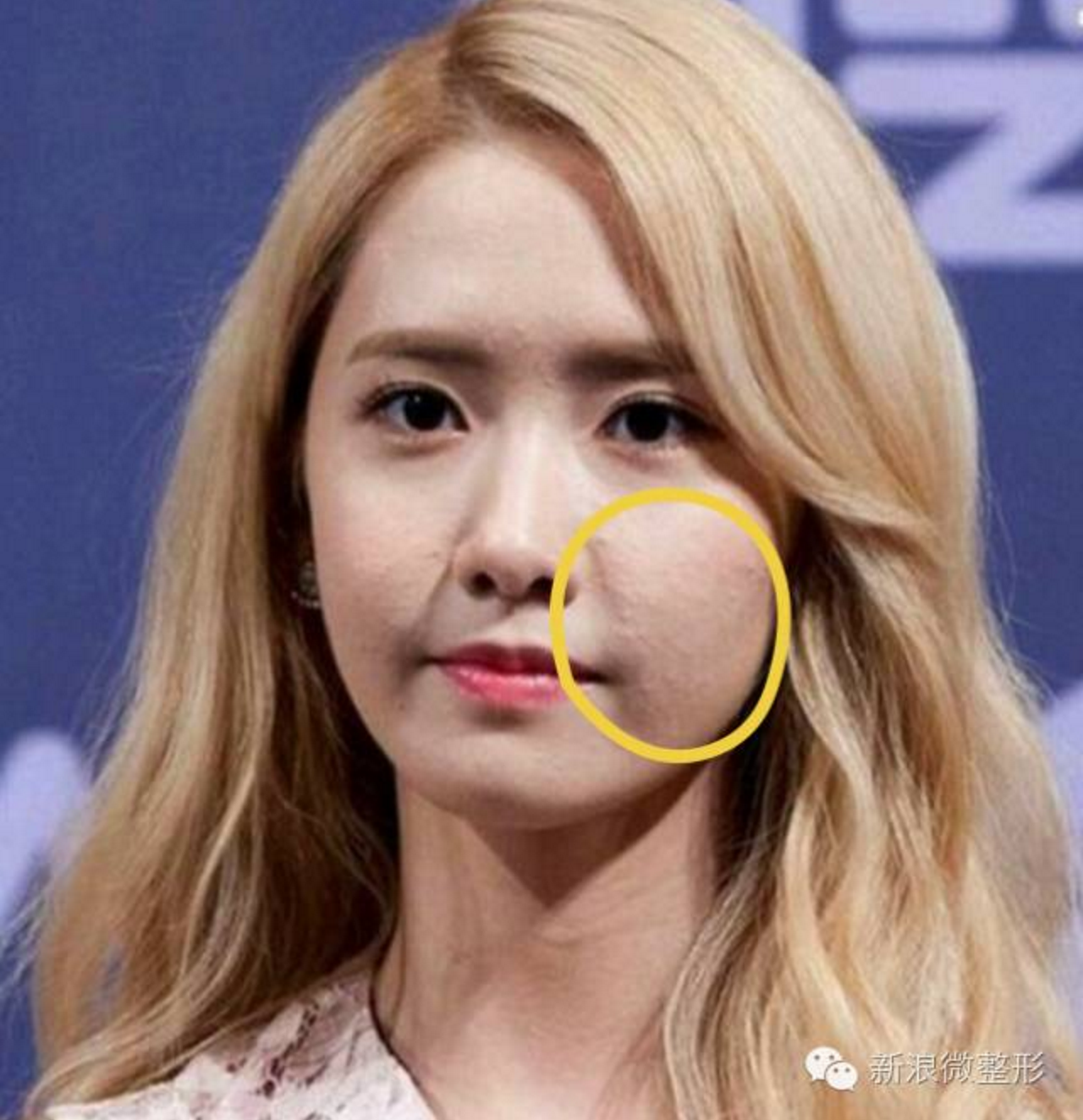 其实这些明星也曾为痘消得人憔悴