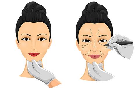 专家解读:常见整形项目的恢复期