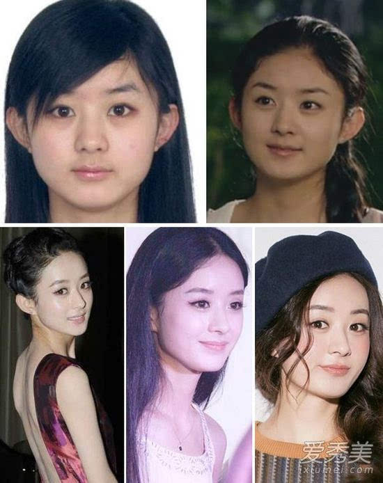 女明星整容后美哭了:杨紫赵丽颖变女神