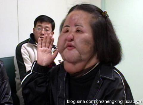 赴韩整形失败的思考