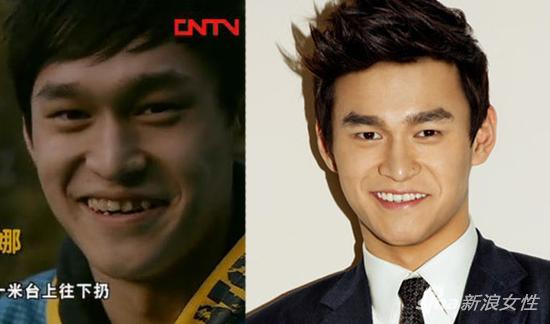 孙杨|牙齿|刘涛_新浪女性_新浪网