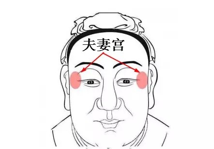 魅力提升:自体脂肪丰太阳穴太阳穴又称夫妻宫,若太阳穴饱满,则夫妻