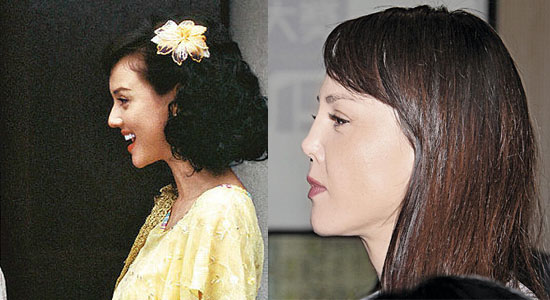 关于鼻子,韩君婷曾否认是整容失败所致,强调是化妆技巧问题,并称没打