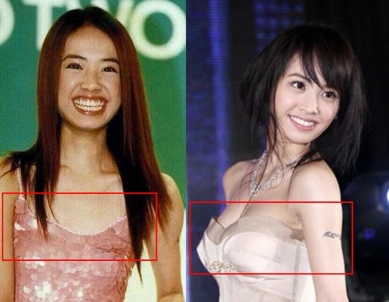 那个说蔡依林隆胸痕迹明显的直男癌患者,你已经病入膏肓了