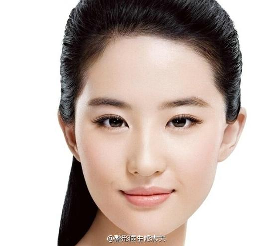 最受欢迎的三种双眼皮