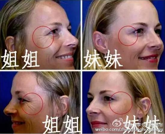 13年之后双胞胎的对比图