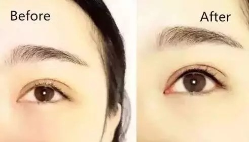 做韩式半永久美瞳线疼吗
