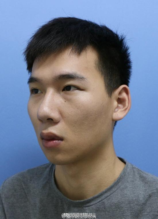 一个完美的下巴能让男人变帅多少