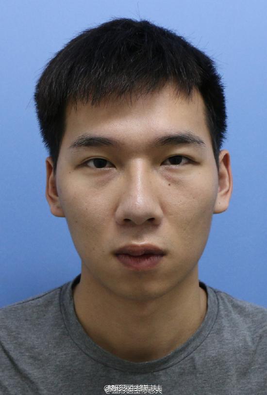 一个完美的下巴能让男人变帅多少