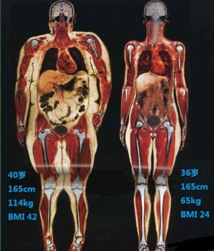 胖子和瘦子对比图片