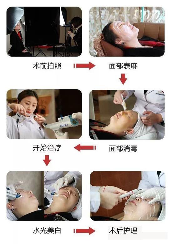 你了解水光针吗?