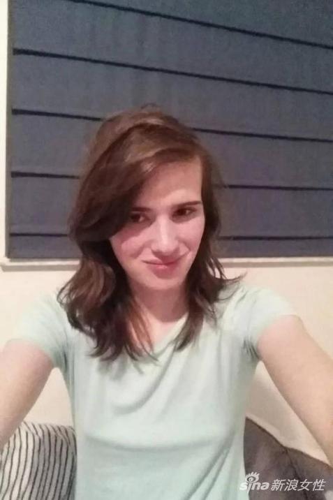 内心小公举的他服用激素十七个月,终于活成了自己期待的样子!