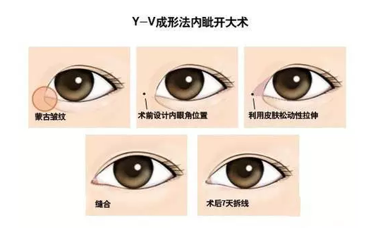 开眼角是一道奥数题试试你能解答吗