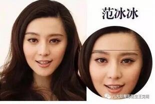 高低眉的看过来,这种方法治疗最有效!