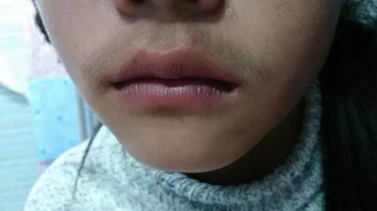 唇毛真的很尴尬,恨不得全拔光有没有!明星的这些小胡子其实