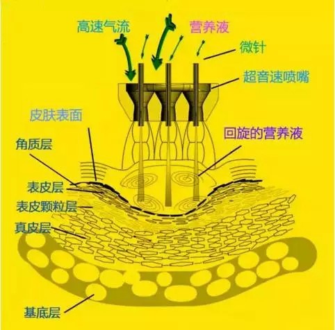 无针水光到底是什么呢?