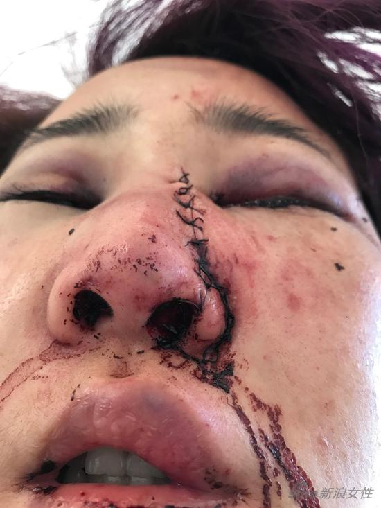 晚上好各位小伙伴们,还记得之前闹得沸沸扬扬的丽江打人事件吗?