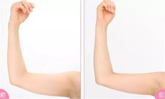 讲真,你的手臂囊肉手感确实不错