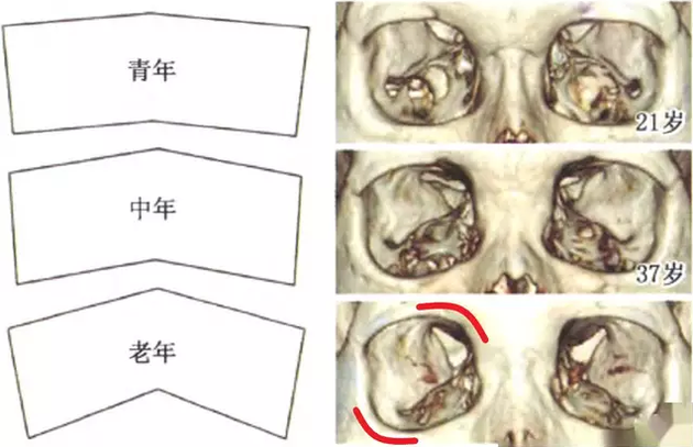 骨骼老化图解