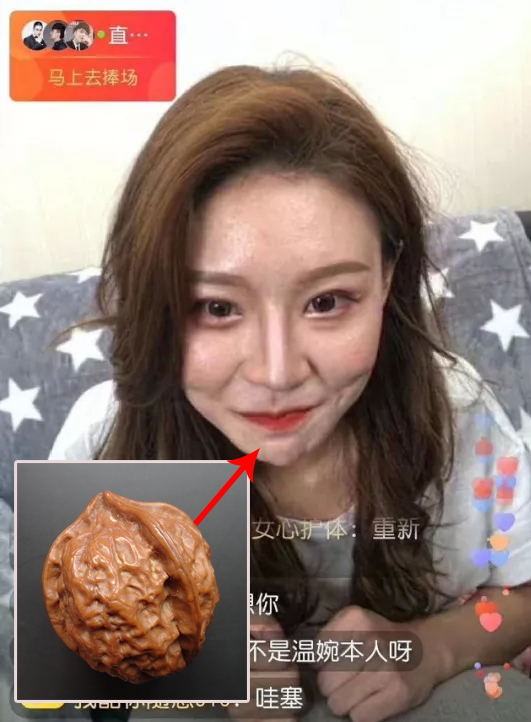 一抿嘴,下巴鼓起凹凸不平的一坨,像一颗核桃↓除了过重的鼻影和与实际