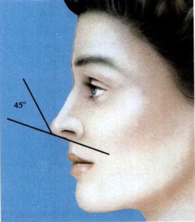 小柱小叶角45度,鼻尖就上翘
