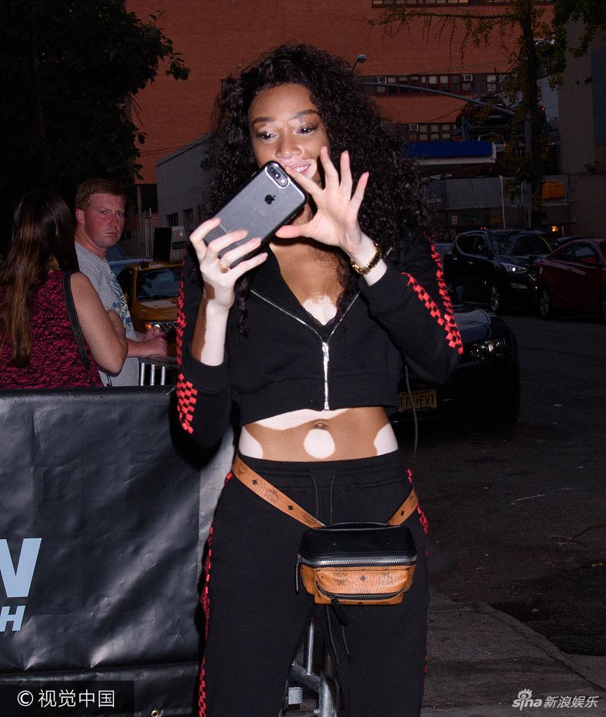 组图:"白癜风超模"温妮·哈洛现身街头露蛮腰