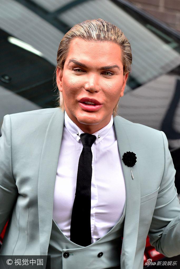 组图:辣眼睛!"整容狂魔"罗德里戈嘴唇厚重下巴疑变形