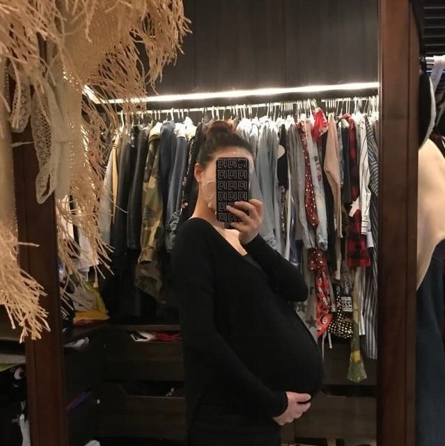 组图:欧弟妻子孕中晒巨肚 自嘲"遍布惊人血管和黑色素"