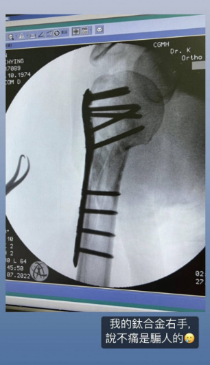 组图：林志颖复出首参加商业活动 面部恢复如初笑容活力